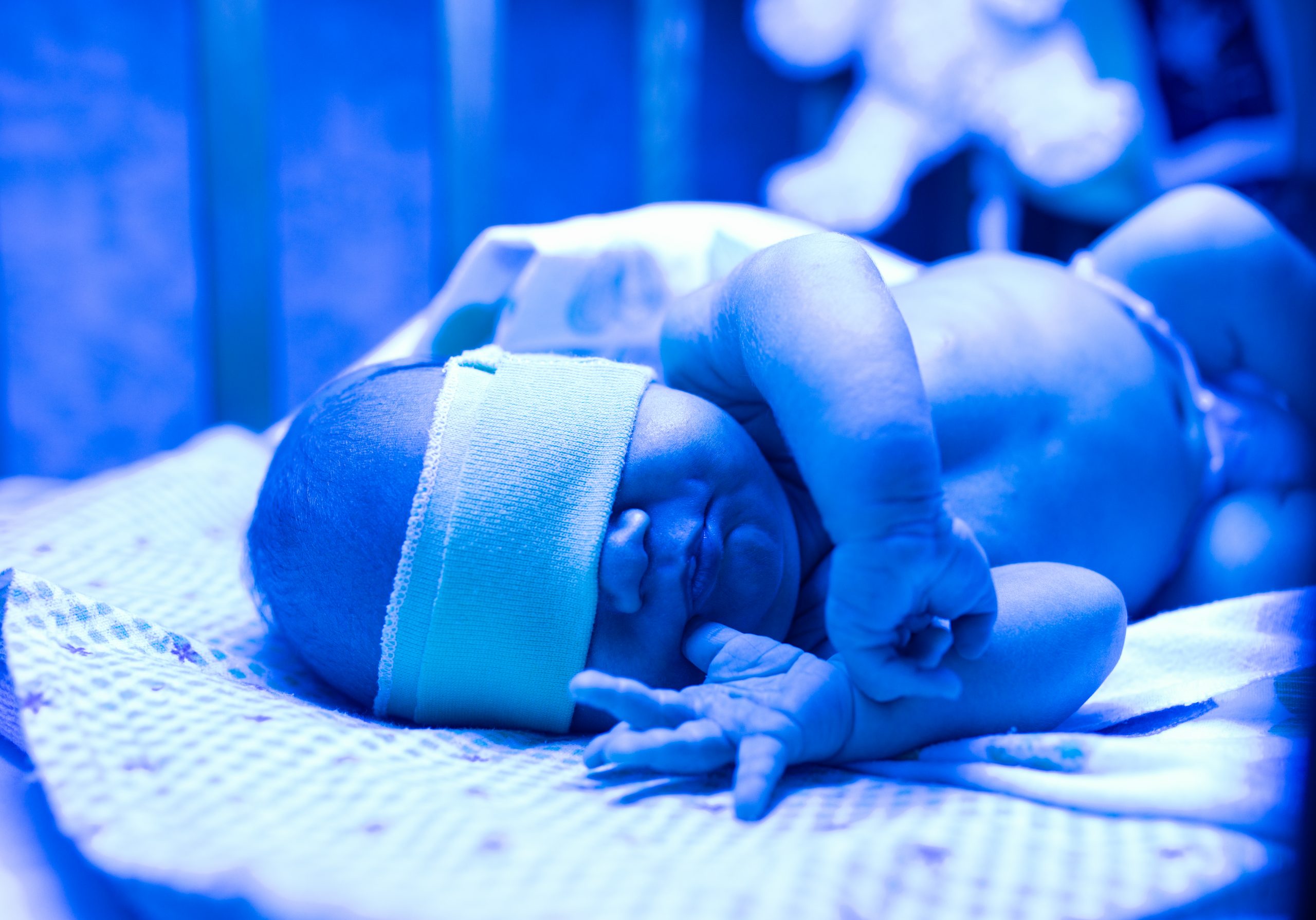 Incubadora neonatal con lámpara de fototerapia