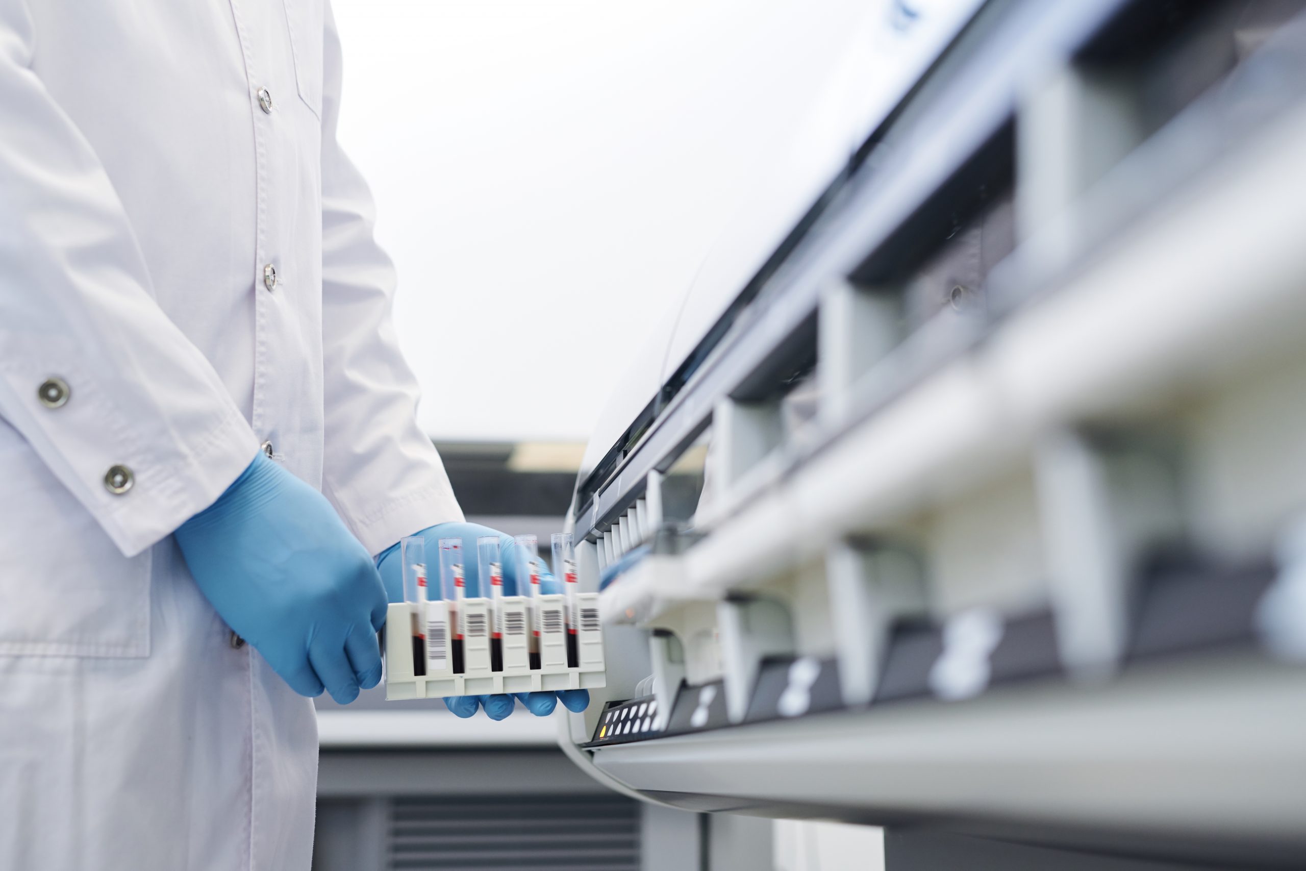 ¿Qué es un analizador de electrolitos?