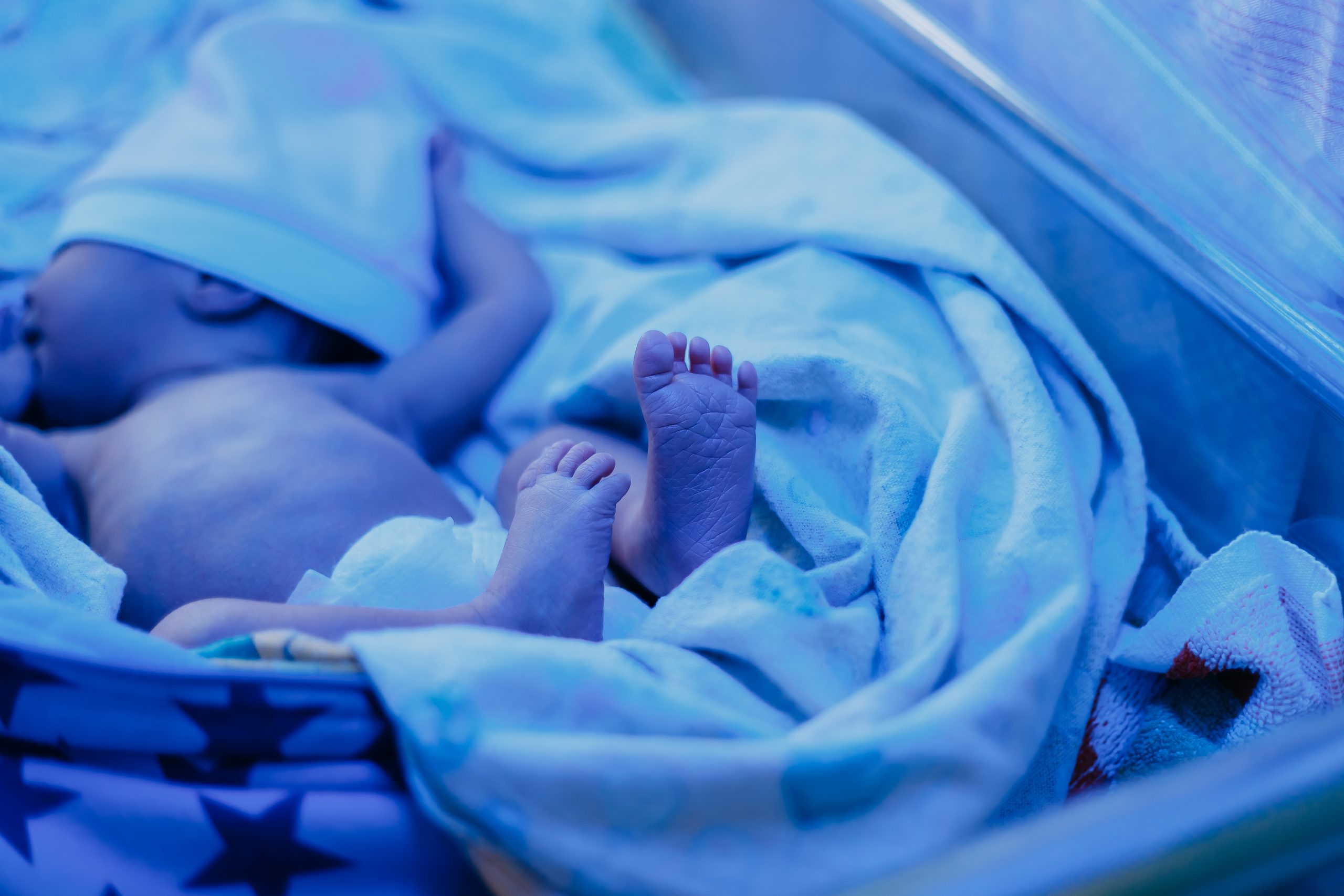 Protocolo de fototerapia en un neonato