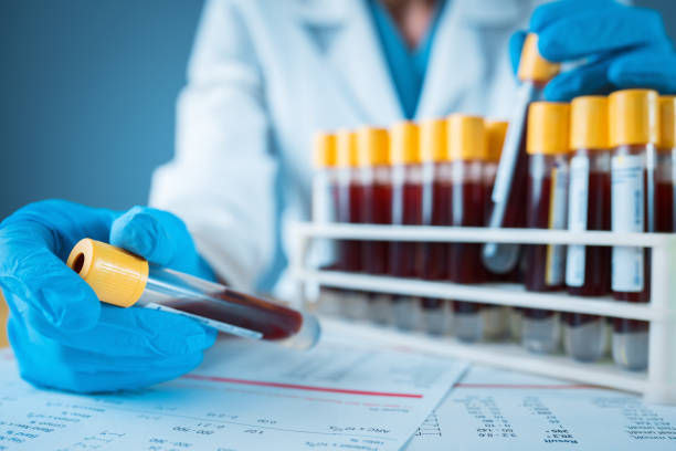 ¿Cuáles son las Características y Aplicaciones de un Analizador de Semen?