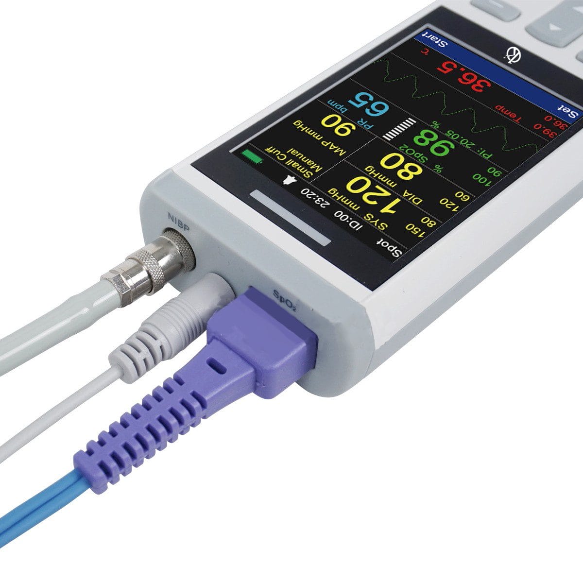 Monitor Veterinario Portátil de Signos Vitales YR06106 – 1